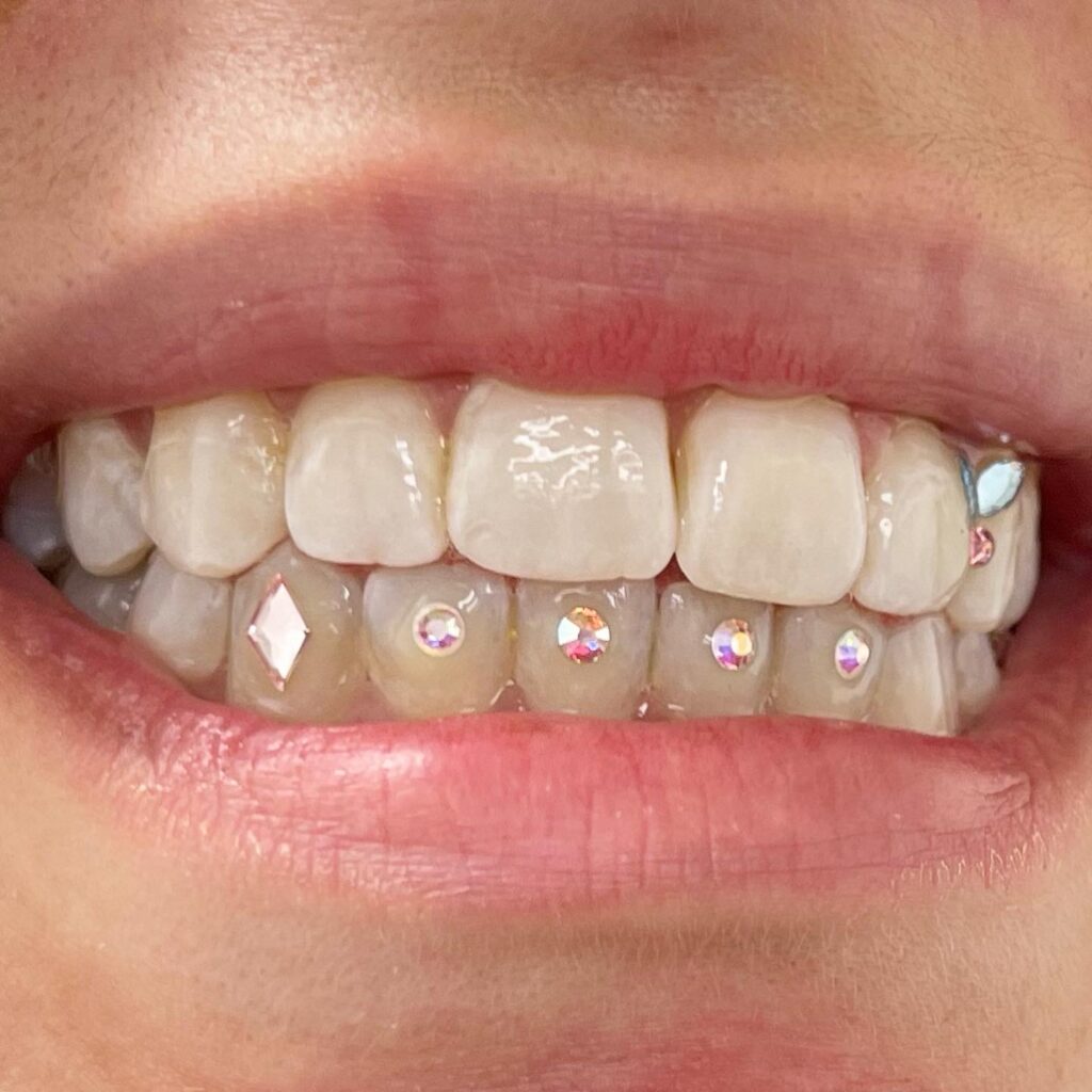 Tooth Gems  Pearly Whites