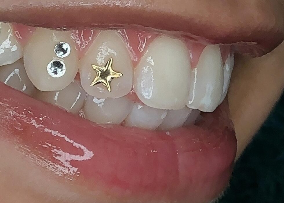 Teeth Gems